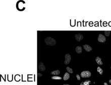 抗-纤连蛋白单克隆抗体 小鼠抗 clone IST-4, purified from hybridoma cell culture