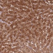 Anti-ADH1A antibody produced in rabbit Prestige Antibodies® Powered by Atlas Antibodies, affinity isolated antibody, buffered aqueous glycerol solution