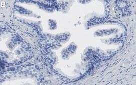 Anti-TIMP-1 Antibody, clone 1H19 ZooMAb® Rabbit Monoclonal recombinant, expressed in HEK 293 cells