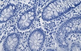 Anti-NPM/B23 Antibody, clone 2H21 ZooMAb® Rabbit Monoclonal recombinant, expressed in HEK 293 cells