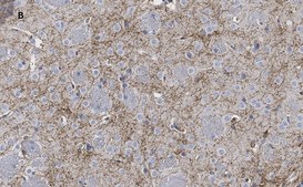 Anti-Tyrosine Hydroxylase Antibody, clone 3M12, ZooMAb® Rabbit Monoclonal recombinant, expressed in HEK 293 cells