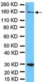 Anti-RAD50 Antibody from rabbit, purified by affinity chromatography