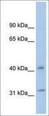 Anti-YWHAQ antibody produced in rabbit affinity isolated antibody