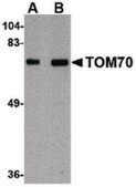 Anti-TOM70 antibody produced in rabbit affinity isolated antibody