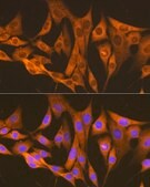 Anti-ASS1 Antibody, clone 4W1M8, Rabbit Monoclonal