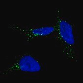 Monoclonal Anti-TYRP1 antibody produced in mouse Prestige Antibodies® Powered by Atlas Antibodies, clone CL4906, purified immunoglobulin, buffered aqueous glycerol solution