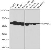 Anti-ALDH1A1 antibody produced in rabbit