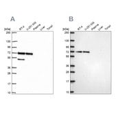 Anti-PAK4 antibody produced in rabbit Prestige Antibodies® Powered by Atlas Antibodies, affinity isolated antibody