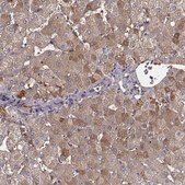 Anti-TF antibody produced in rabbit Ab2, Prestige Antibodies® Powered by Atlas Antibodies, affinity isolated antibody, buffered aqueous glycerol solution