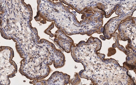 Anti-Integrin α-5 Antibody, clone 5E18 ZooMAb® Rabbit Monoclonal recombinant, expressed in HEK 293 cells