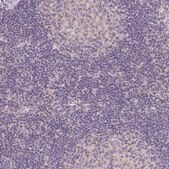 Anti-SMTN antibody produced in rabbit Prestige Antibodies® Powered by Atlas Antibodies, affinity isolated antibody, buffered aqueous glycerol solution