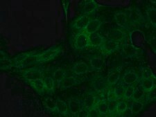 Anti-Calreticulin antibody produced in rabbit IgG fraction of antiserum, buffered aqueous solution