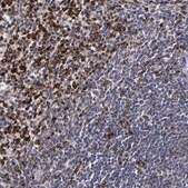 Anti-CTSS antibody produced in rabbit Prestige Antibodies® Powered by Atlas Antibodies, affinity isolated antibody, buffered aqueous glycerol solution