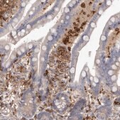 Anti-CBL antibody produced in rabbit Prestige Antibodies® Powered by Atlas Antibodies, affinity isolated antibody, buffered aqueous glycerol solution