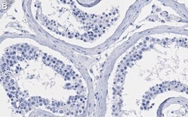 Anti-Centrin-1 Antibody, clone 5L17 ZooMAb® Rabbit Monoclonal recombinant, expressed in HEK 293 cells