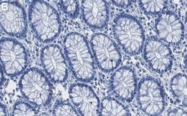 Anti-Rictor Antibody, clone 1K9 ZooMAb® Rabbit Monoclonal recombinant, expressed in HEK 293 cells