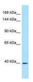 Anti-IL6ST antibody produced in rabbit affinity isolated antibody