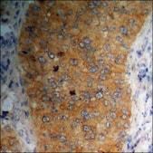 Anti-phospho-PAK4/5/6 (pSer474) antibody produced in rabbit affinity isolated antibody