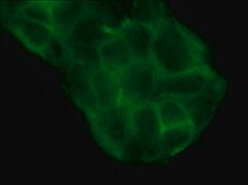 Anti-l/s-Afadin antibody produced in rabbit affinity isolated antibody