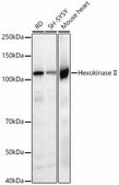 [KO Validated]Anti-Hexokinase II Antibody, clone 5N8G9, Rabbit Monoclonal