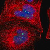Anti-ACTN4 antibody produced in rabbit Prestige Antibodies® Powered by Atlas Antibodies, affinity isolated antibody, buffered aqueous glycerol solution