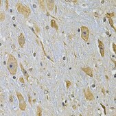 Anti-ITGA2 antibody produced in rabbit