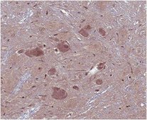 抗-GABA抗体 from rabbit, purified by affinity chromatography