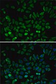 Anti-CDK4 antibody produced in rabbit