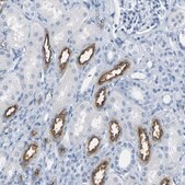 Anti-SLC12A1 antibody produced in rabbit Prestige Antibodies® Powered by Atlas Antibodies, affinity isolated antibody, buffered aqueous glycerol solution