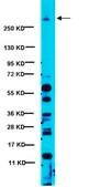 Anti-IP3 Receptor 1 Antibody serum, from rabbit