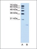 Anti-ACP1 antibody produced in rabbit IgG fraction of antiserum