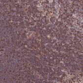 Anti-CDC25B antibody produced in rabbit Prestige Antibodies® Powered by Atlas Antibodies, affinity isolated antibody, buffered aqueous glycerol solution