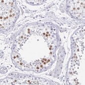 Anti-SYCP3 antibody produced in rabbit Prestige Antibodies® Powered by Atlas Antibodies, affinity isolated antibody, buffered aqueous glycerol solution