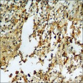 Anti-phospho-Smad3 (pSer213) antibody produced in rabbit affinity isolated antibody