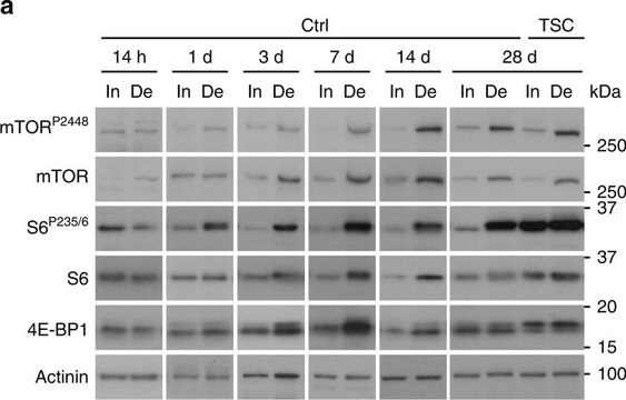 Monoclonal Anti-α-Actinin antibody produced in mouse clone BM-75.2, ascites fluid