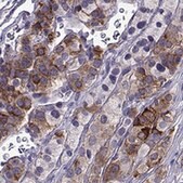 Anti-IGSF1 antibody produced in rabbit Prestige Antibodies® Powered by Atlas Antibodies, affinity isolated antibody