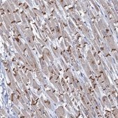 Anti-TMX2 antibody produced in rabbit Prestige Antibodies® Powered by Atlas Antibodies, affinity isolated antibody, buffered aqueous glycerol solution