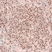 Monoclonal Anti-Msh3 Antibody Produced In Mouse Prestige Antibodies® Powered by Atlas Antibodies, clone CL14064, affinity isolated antibody, buffered aqueous glycerol solution