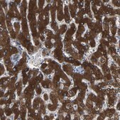Anti-FTCD antibody produced in rabbit Prestige Antibodies® Powered by Atlas Antibodies, affinity isolated antibody, buffered aqueous glycerol solution