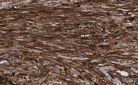 Anti-β-Actin Antibody, clone 6L12, ZooMAb® Rabbit Monoclonal recombinant, expressed in HEK 293 cells