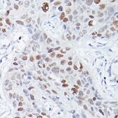 Anti-RBPJK antibody produced in rabbit