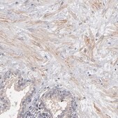 Anti-DMD antibody produced in rabbit Prestige Antibodies® Powered by Atlas Antibodies, affinity isolated antibody, buffered aqueous glycerol solution