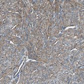 Anti-ACTN1 antibody produced in rabbit Prestige Antibodies® Powered by Atlas Antibodies, affinity isolated antibody, buffered aqueous glycerol solution