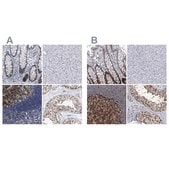 Anti-PCNA antibody produced in rabbit Prestige Antibodies® Powered by Atlas Antibodies, affinity isolated antibody, buffered aqueous glycerol solution, ab1