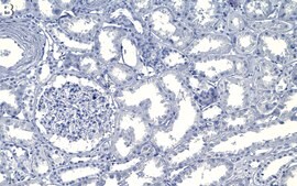 Anti-N-WASP Antibody, clone 1D16 ZooMAb® Rabbit Monoclonal recombinant, expressed in HEK 293 cells