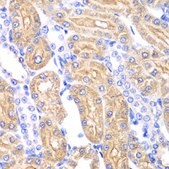Anti-ALDH2 antibody produced in rabbit