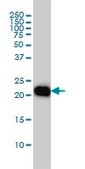 Monoclonal Anti-RHOA antibody produced in mouse clone 1B12, purified immunoglobulin, buffered aqueous solution