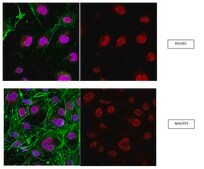 抗 RNF168 抗体 from rabbit, purified by affinity chromatography