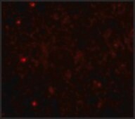 Anti-TOM70 antibody produced in rabbit affinity isolated antibody