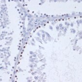 Anti-Phospho-γH2A.X-S139 antibody produced in rabbit